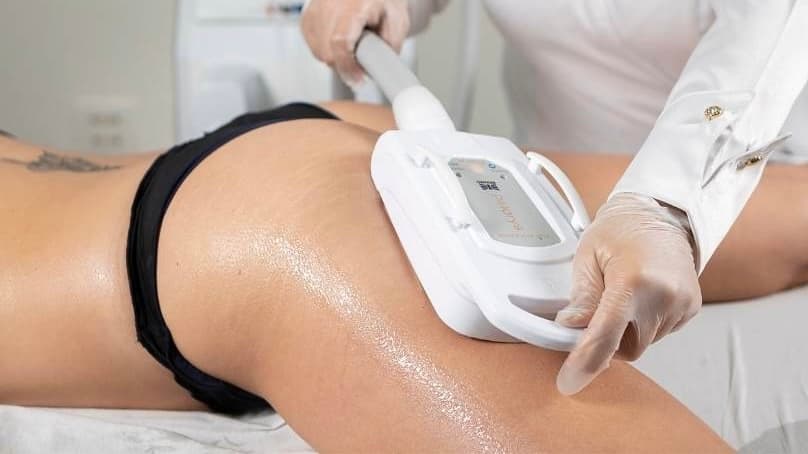 Criolipólise Móvel Flacidez Celulite e Lipedema